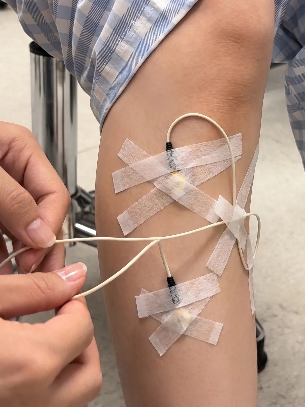 Electrodes and lead wires attached at the leg for polysomnography